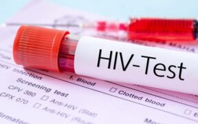 مهم‌ترین چالش امروز HIV در ایران