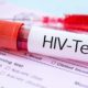 مهم‌ترین چالش امروز HIV در ایران