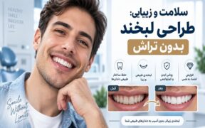 بازسازی لبخند پس از ازدست‌دادن دندان؛ از ایمپلنت تا طراحی لبخند